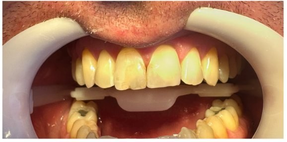 Antes da renovação estética