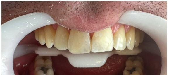 Depois da renovação estética