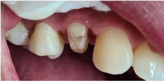 Antes da restauração