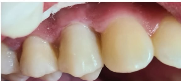 Depois da restauração